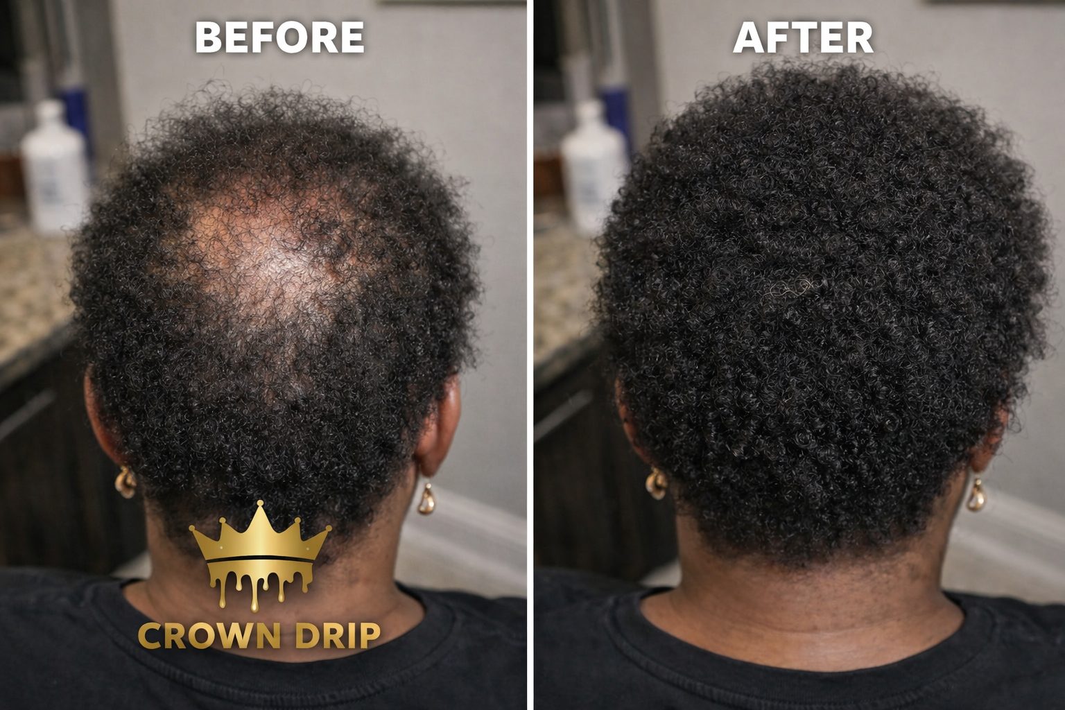 Crown Drip